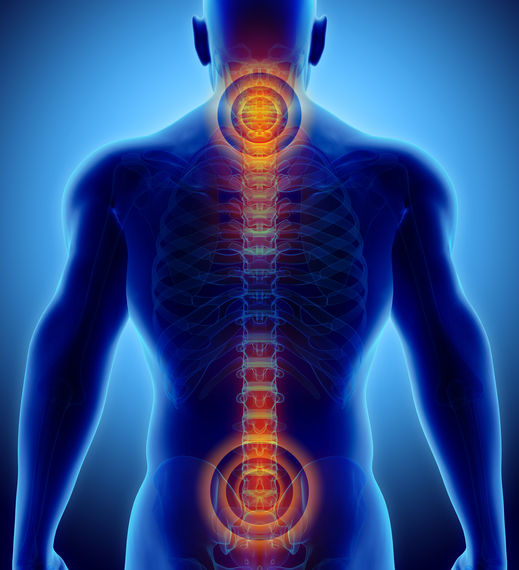 Louisville Neck Back Soft Tissue Injury Attorney